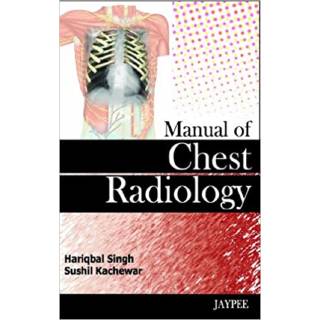 Manual of Chest Radiology 1st Edition