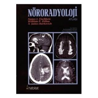 Nöroradyoloji Atlası