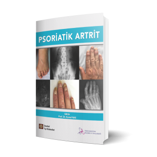 Psoriatik Artrit