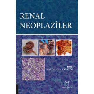 Renal Neoplaziler