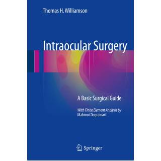 Intraocular Surgery A Basic Surgical Guide